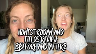 My Honest Rodan and Fields Skincare Review [upl. by Rohn]