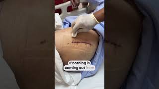 How to do surgical dressing at home like a DOCTOR  wounddressing totalhipreplacementsurgery [upl. by Nner]