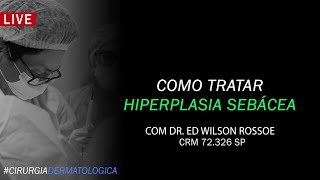 COMO TRATAR HIPERPLASIA SEBÁCEA  DR ED WILSON ROSSOE  CIRURGIA DERMATOLÓGICA [upl. by Oakleil]