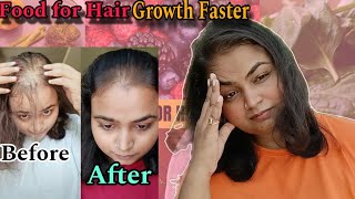 Food for faster hair growth  Hair growth Diet [upl. by Niko]