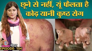 कुष्ठ रोग यानी Leprosy किसे और कैसे हो सकता है यहां जान लीजिए  Sehat ep 104 [upl. by Ramah]