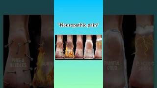 NEUROPATHIC PAIN health [upl. by Annawoj518]