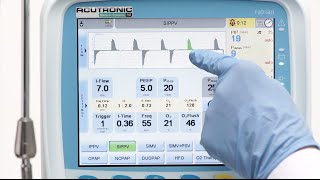 fabian HFO SIPPV Synchronised Intermittent Positive Pressure Ventilation [upl. by Sinclair]