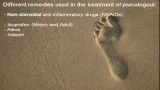 Different Remedies Used in the Treatment of Pseudogout [upl. by Nadine]