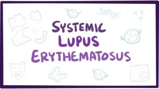 Systemic lupus erythematosus SLE  causes symptoms diagnosis amp pathology [upl. by Ayotnahs77]