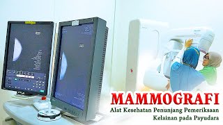 TESTIMONI ALAT KESEHATAN BANTUAN PEMERINTAH TA 2022  MAMMOGRAFI [upl. by Attolrac593]