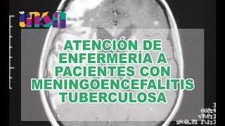 Atención de Enfermería a Pacientes con Meningoencefalitis Tuberculosa [upl. by Llerreg]