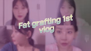 fat grafting 1st plastic surgery vlog  lovely face  korea plastic surgery [upl. by Kcirevam]