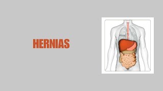 HERNIAS  2024  II  USMP [upl. by Sakhuja]