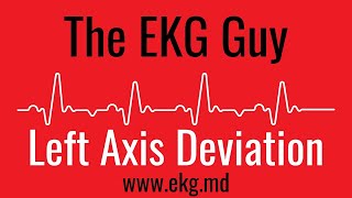 Left Axis Deviation on EKG  ECG l The EKG Guy  wwwekgmd [upl. by Acinoed999]