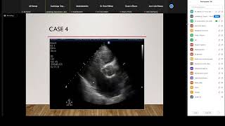 Transthoracic Echo Cases Dr Viola William [upl. by Korb216]