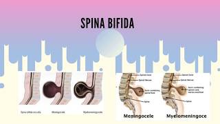 Spina Bifida Types of Spina Bifida [upl. by Llerruj199]