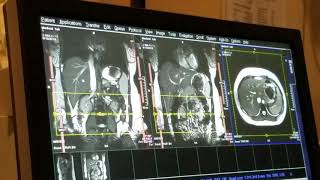 School of Medical Imaging MRI Lab  Abdomen Part I [upl. by Isiah]