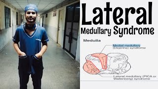 Lateral Medullary Syndrome Neuro medicine viva [upl. by Elahcar]