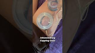 Cupping Therapy functional [upl. by Lelah]