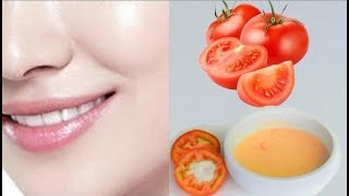 TOMATE 🍅 para Blanquear la Piel en 15 Minutos 😱 Facial de Tomate para Eliminar las Manchas Oscuras [upl. by Nylaroc]