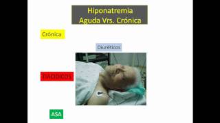 Hiponatremia Parte No 2mp4 [upl. by Derr]