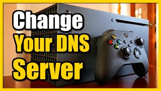 How to Change DNS Server on Xbox Series X Fast Tutorial [upl. by Grath]