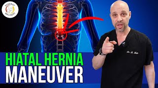 Try Hiatal Hernia Maneuver before Surgery [upl. by Isa]