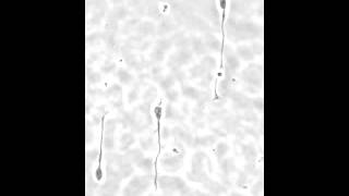 Axon growth cone of primary rat hippocampal neurons on Motility CYTOOchips [upl. by Atinot]