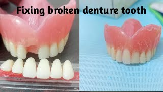 How to fix broken denture tooth [upl. by Rriocard]