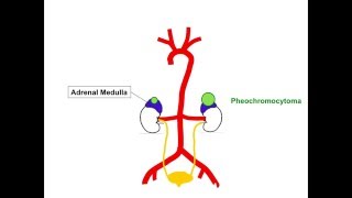 Pheochromocytoma and Paraganglioma Concept Video [upl. by Ford584]