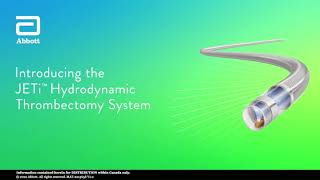 JETi Hydrodynamic Thrombectomy System MOA [upl. by Mercola]