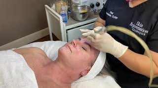 Microdermabrasion Facial Demonstration [upl. by Mart]