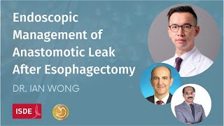 Endoscopic Management of Anastomotic Leak After Esophagectomy  Dr Ian Wong [upl. by Vonny]