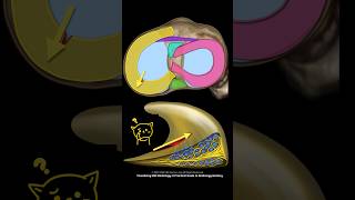 Fig 1B06 partialthickness Radial Meniscal Tears [upl. by Hagerman]