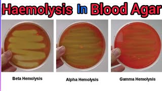 Types Of Haemolysis on Blood Agar Media AlphaBeta amp Gama Haemolysis  Streptococcus Spp [upl. by Nisay]