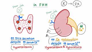 Familial Hypocalcuric Hypercalcemia FHH  Endocrinology and Nephrology [upl. by Capriola]