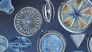 Beautiful Diatoms [upl. by Daye]