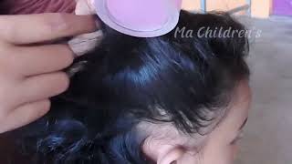 ASMR Lice and Nits Removal for Ultimate Scalp Check  Satisfying [upl. by Clemente738]