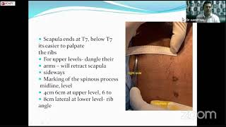 Intercostal nerve block indications contraindications techniques  Dr Susmit Naskar [upl. by Drawets954]