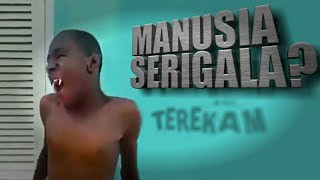 SEREM Sedang Diperiksa TibaTiba Anak Ini Berubah Jadi Manusia Serigala [upl. by Egnalos763]