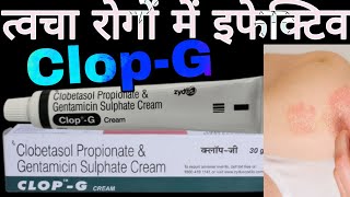 CLOPG Cream Uses in Hindi  Clobetasol Propionate amp Gentamicin Sulphate Cream [upl. by Allenaj]