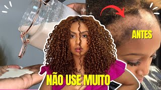 O CABELO CRESCE EM 10 DIAS COM APENAS 2 INGREDIENTES COMBATE A QUEDA CAPILAR [upl. by Ragas]