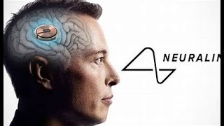 Neuralink Il Futuro del Cervello Umano o Fantascienza [upl. by Haleemak]