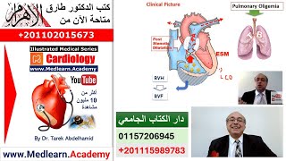 Pulmonary Stenosis cme internalmedicine ecg usmle medical محاضراتباطنة [upl. by Prager]