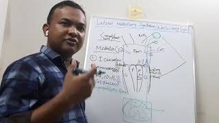 Lateral Medullary Syndrome in bangla [upl. by Aiselad]