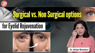 Under Eye Aging Treatment  Non Surgical Eyelid Lift  Types of Eyelid Surgery  SB Aesthetics [upl. by Iturk]