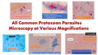 All Common Protozoan Parasites under the Microscope GiardiaAmoeba TrichomonasCyclosporaCryptosp [upl. by Duax]