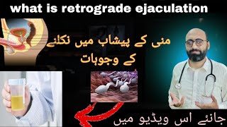 Understanding Retrograde EjaculationCauses and SymptomsManaging Retrograde Ejaculation [upl. by Babara]