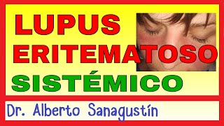 LUPUS ERITEMATOSO SISTÉMICO LES Síntomas Fisiopatología y Tratamiento [upl. by Melany]