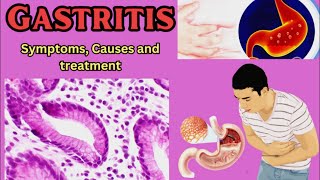 Gastritis Symptoms Causes and Treatment [upl. by Hazeefah]