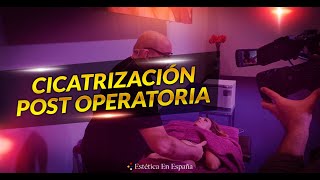 PROCESO DE CICATRIZACIÓN POST OPERATORIO  DRENAJE LINFÁTICO MANUAL VODDER [upl. by Anitnahs]