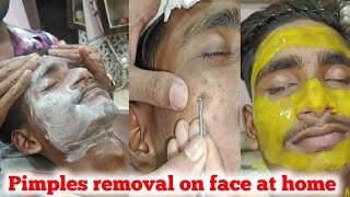 Pimples removal on face at home Pimples thik karne ka sahi tarika [upl. by Soilissav697]