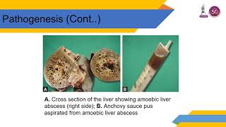 PARASITIC INFECTIONS OF HEPATOBILIARY SYSTEM [upl. by Anavrin]