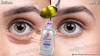 In 3 days Remove Under Eye Bags Completely  Remove Dark Circles Wrinkles and Puffy Eyes [upl. by Inirt]